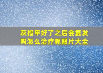 灰指甲好了之后会复发吗怎么治疗呢图片大全