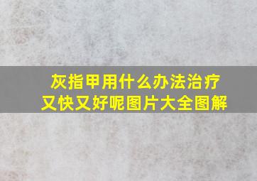 灰指甲用什么办法治疗又快又好呢图片大全图解