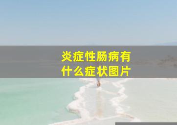 炎症性肠病有什么症状图片