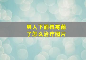 男人下面得霉菌了怎么治疗图片