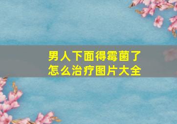 男人下面得霉菌了怎么治疗图片大全