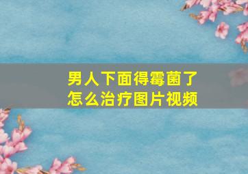 男人下面得霉菌了怎么治疗图片视频