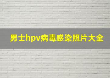 男士hpv病毒感染照片大全