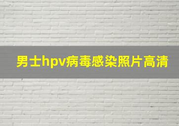 男士hpv病毒感染照片高清