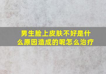 男生脸上皮肤不好是什么原因造成的呢怎么治疗