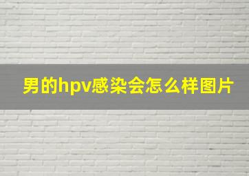 男的hpv感染会怎么样图片