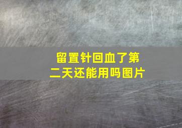 留置针回血了第二天还能用吗图片