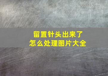 留置针头出来了怎么处理图片大全