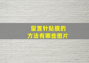 留置针贴膜的方法有哪些图片