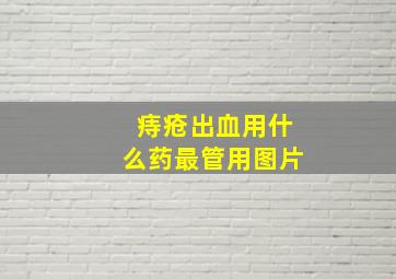 痔疮出血用什么药最管用图片