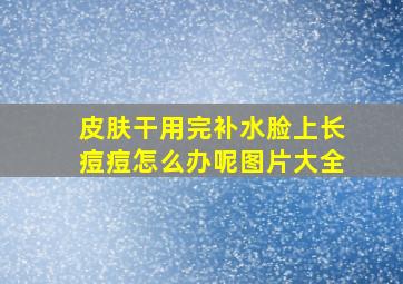 皮肤干用完补水脸上长痘痘怎么办呢图片大全