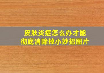 皮肤炎症怎么办才能彻底消除掉小妙招图片