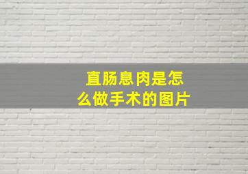 直肠息肉是怎么做手术的图片