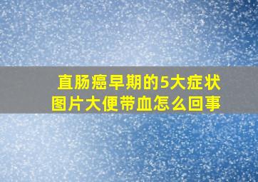 直肠癌早期的5大症状图片大便带血怎么回事