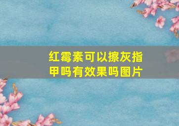 红霉素可以擦灰指甲吗有效果吗图片