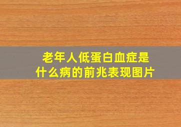 老年人低蛋白血症是什么病的前兆表现图片