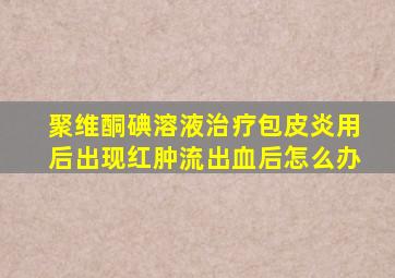 聚维酮碘溶液治疗包皮炎用后出现红肿流出血后怎么办