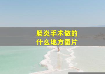 肠炎手术做的什么地方图片