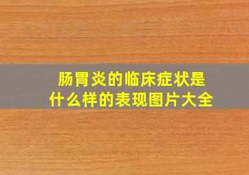 肠胃炎的临床症状是什么样的表现图片大全