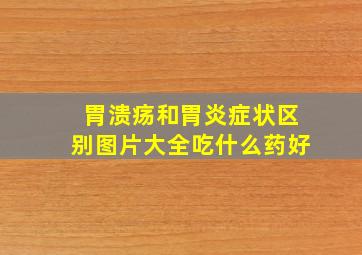 胃溃疡和胃炎症状区别图片大全吃什么药好