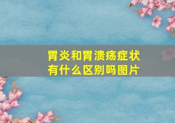 胃炎和胃溃疡症状有什么区别吗图片