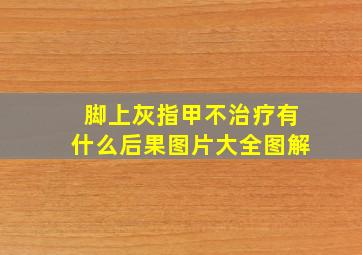 脚上灰指甲不治疗有什么后果图片大全图解