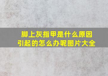 脚上灰指甲是什么原因引起的怎么办呢图片大全