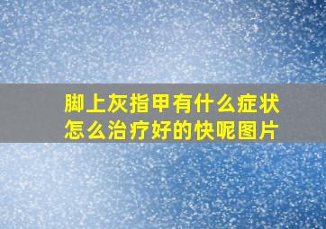 脚上灰指甲有什么症状怎么治疗好的快呢图片