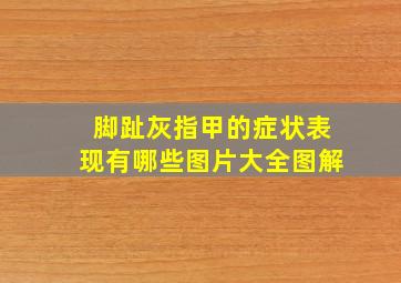 脚趾灰指甲的症状表现有哪些图片大全图解