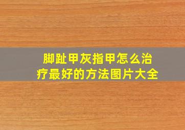 脚趾甲灰指甲怎么治疗最好的方法图片大全