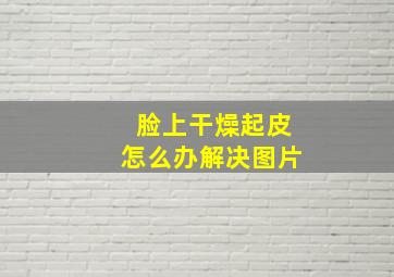 脸上干燥起皮怎么办解决图片