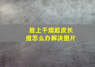 脸上干燥起皮长痘怎么办解决图片