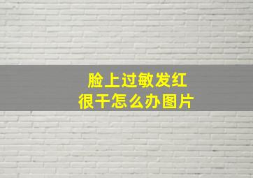 脸上过敏发红很干怎么办图片