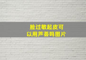 脸过敏起皮可以用芦荟吗图片