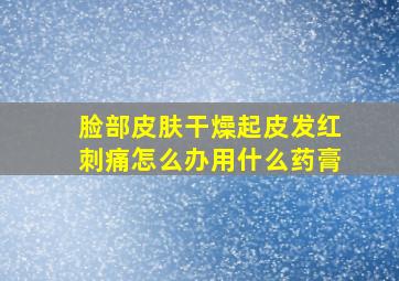 脸部皮肤干燥起皮发红刺痛怎么办用什么药膏