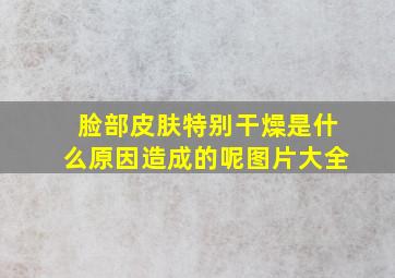 脸部皮肤特别干燥是什么原因造成的呢图片大全