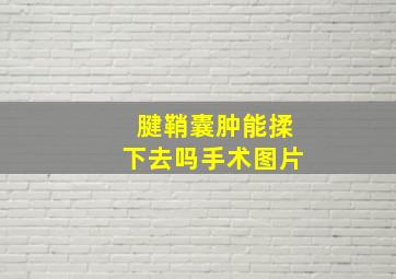 腱鞘囊肿能揉下去吗手术图片