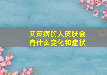 艾滋病的人皮肤会有什么变化和症状