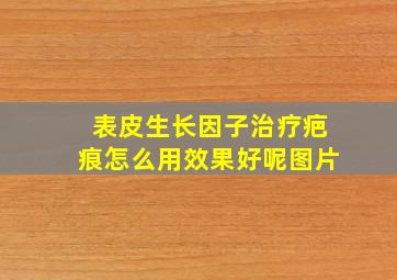 表皮生长因子治疗疤痕怎么用效果好呢图片