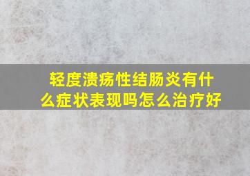 轻度溃疡性结肠炎有什么症状表现吗怎么治疗好