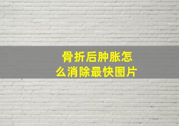 骨折后肿胀怎么消除最快图片