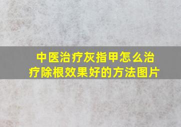 中医治疗灰指甲怎么治疗除根效果好的方法图片