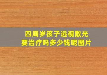 四周岁孩子远视散光要治疗吗多少钱呢图片