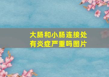 大肠和小肠连接处有炎症严重吗图片