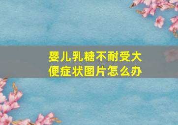 婴儿乳糖不耐受大便症状图片怎么办