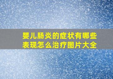 婴儿肠炎的症状有哪些表现怎么治疗图片大全