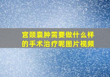 宫颈囊肿需要做什么样的手术治疗呢图片视频