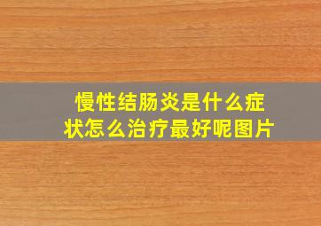 慢性结肠炎是什么症状怎么治疗最好呢图片