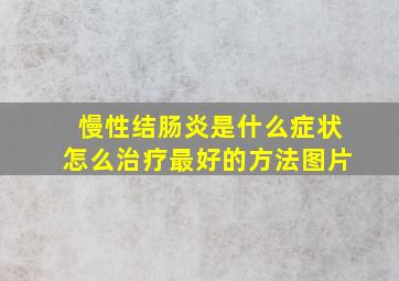 慢性结肠炎是什么症状怎么治疗最好的方法图片