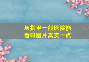 灰指甲一般医院能看吗图片真实一点